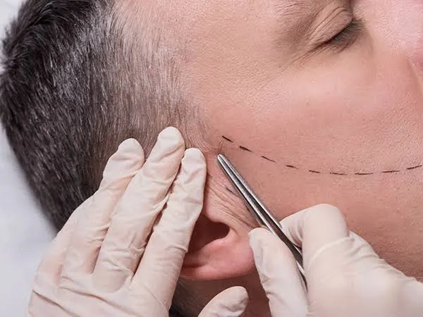 Sakal ve bıyık ekimi